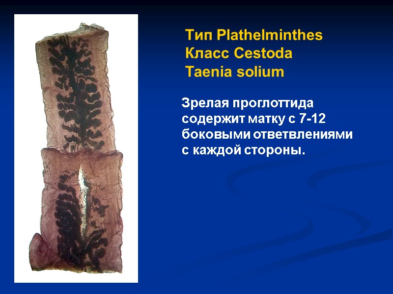 Зрелая проглоттида содержит матку с 7-12 боковыми ответвлениями с каждой стороны.  Тип Plathelminthes